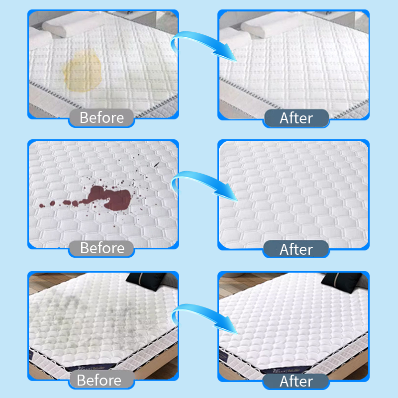 🎉 Powerful Mattress Yellow Stain Cleaner