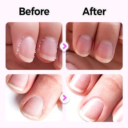 🌟2025 New Upgraded 3-in-1 Nail Care Pen💅
