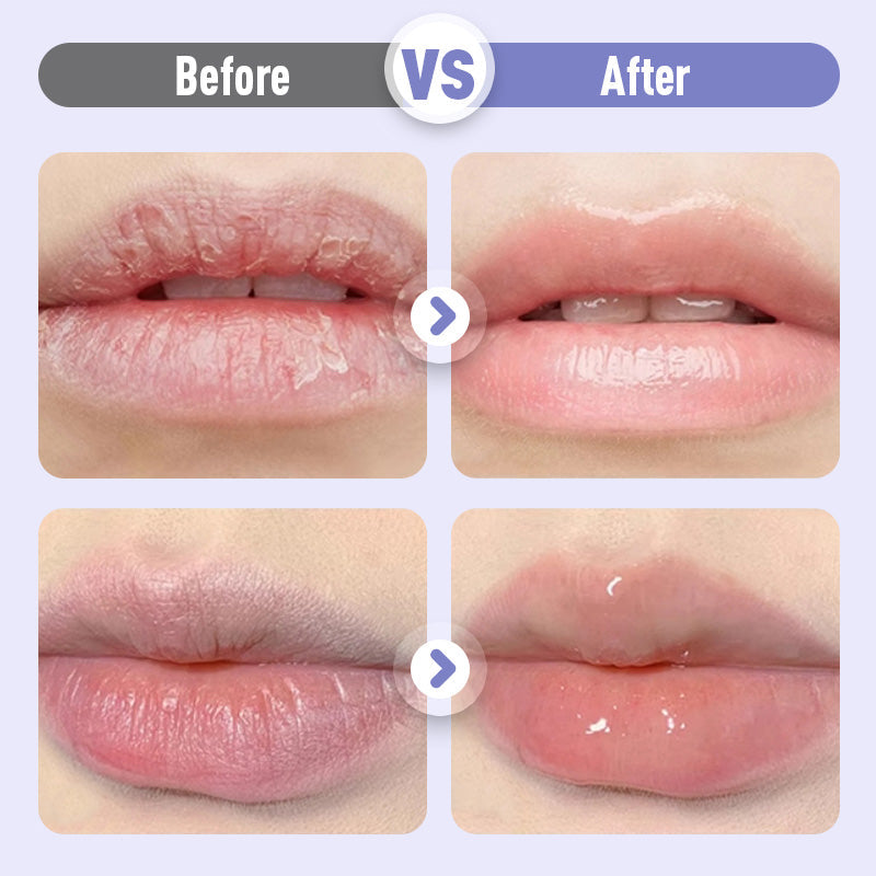 ❣️Buy 1 Get 1 Free❣️Plumping & Anti-Wrinkle Hydrating Lip Serum