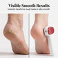 🎉  Buy More Save More🔥 🦶 Double Sided Stainless Steel Foot Scraper Callus Remover ✨