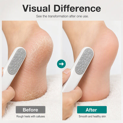 🦶🔥HOT SALE! Dual-Sided Foot File Callus Remover