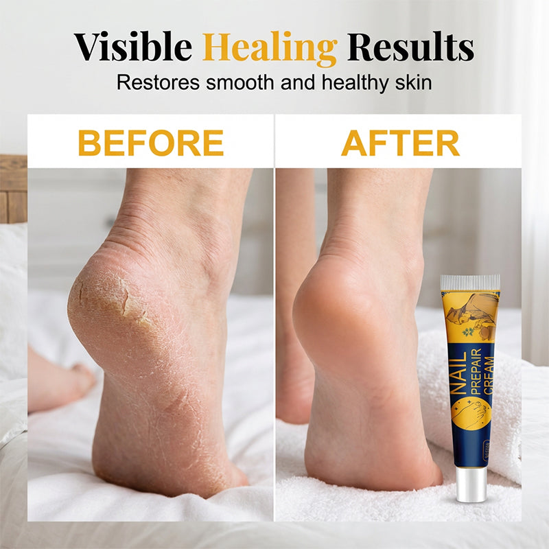 🦶 Intensive Moisturizing Foot Cream | Deep Hydration for Dry, Rough & Cracked-Looking Heels