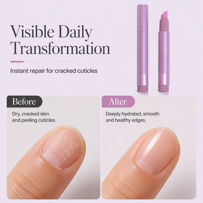 ✨BUY 2 GET 1 FREE!🌟✨Portable Nail Care Essence Pen – Precise Cuticle Moisturizing Treatment, Smooth Applicator Tip & Compact Travel-Friendly Design – Healthy Nails Anywhere, Anytime💅