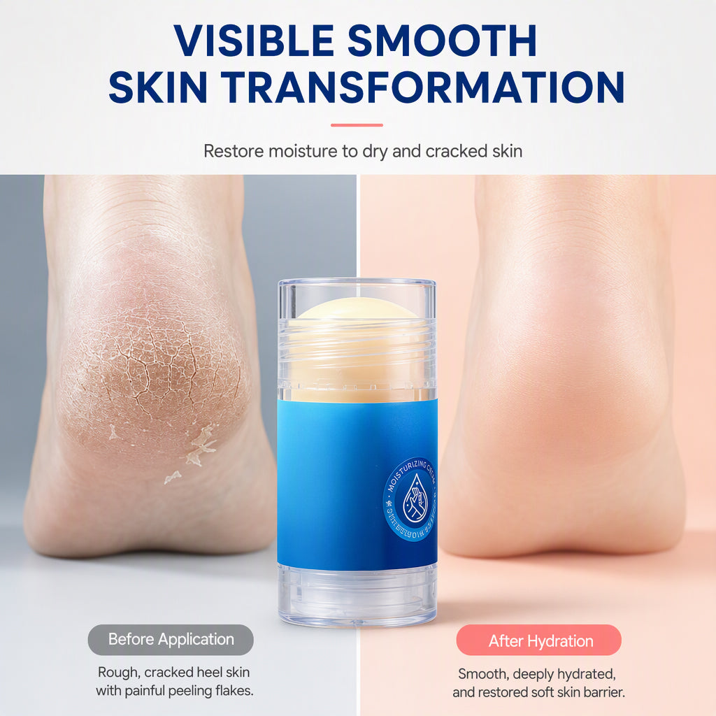 Heal Dry Hands & Heels Instantly! Squalane Moisture Balm Stick